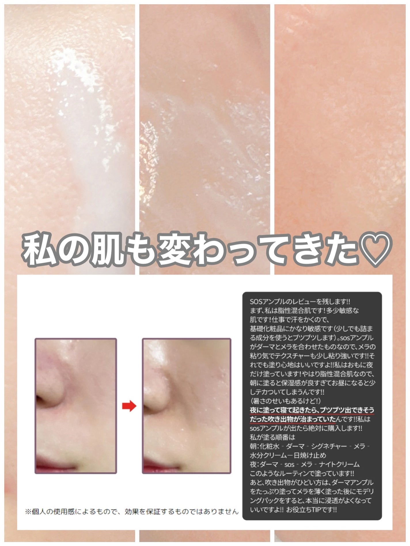 SOSメルダーシステム/KOPHER/フェイスクリームを使ったクチコミ(2枚目)