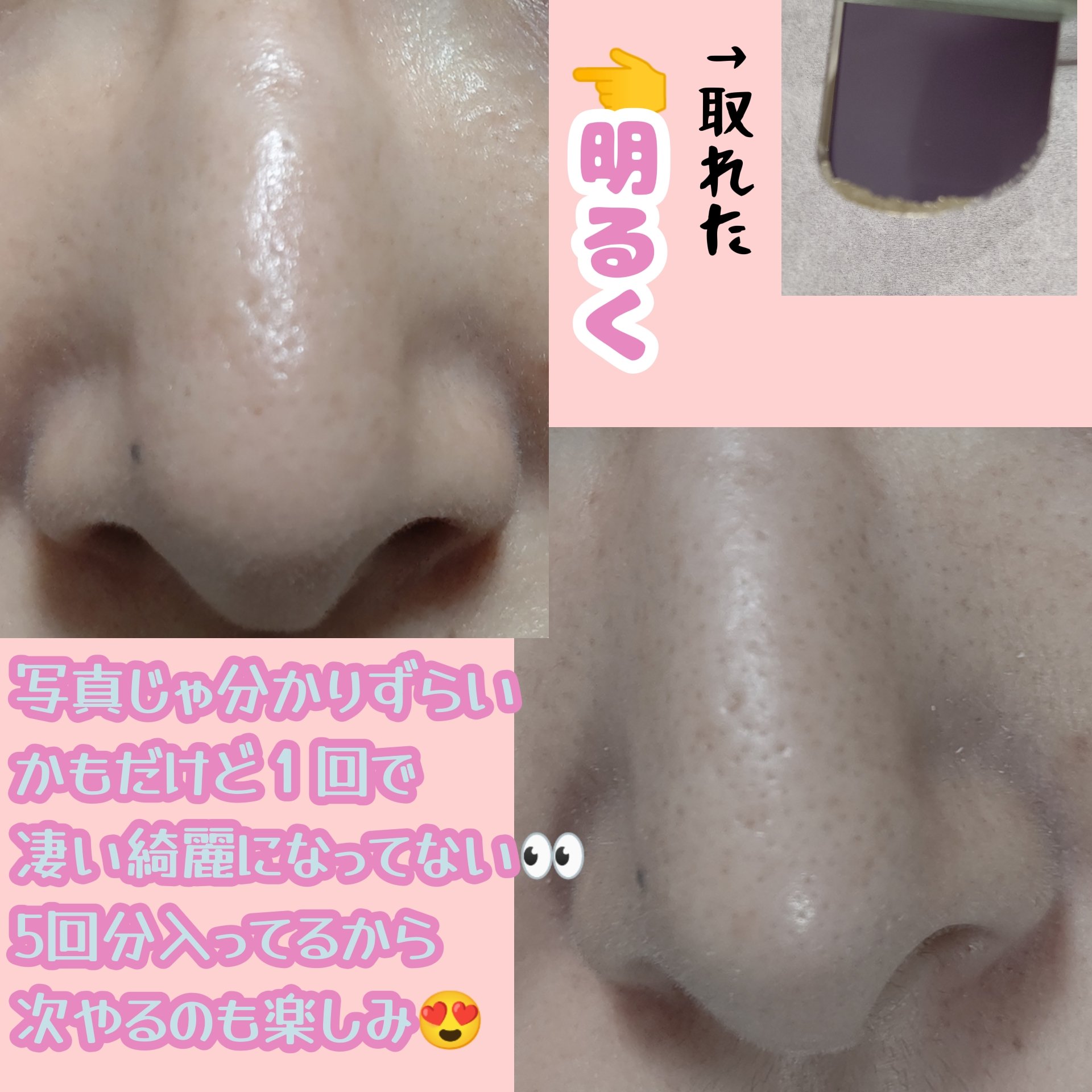 ナチュラルマイルドクリアノーズパック/ilso/シートマスク・パックを使ったクチコミ（3枚目）