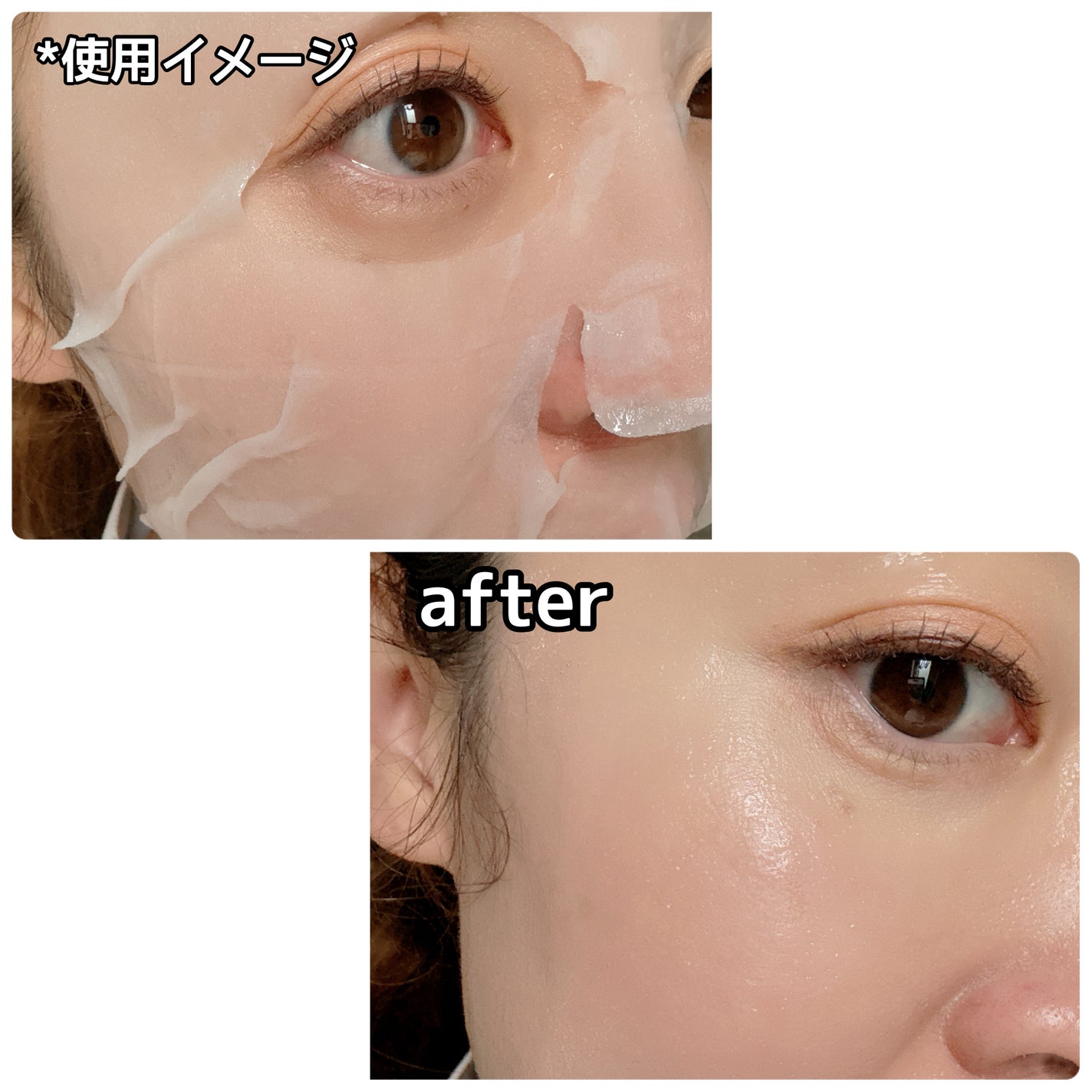 リードルS PDRN+ マスク/VT/シートマスク・パックを使ったクチコミ(4枚目)