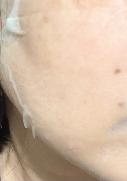 PDRN+ デイリーマスク/VT/シートマスク・パックを使ったクチコミ(2枚目)