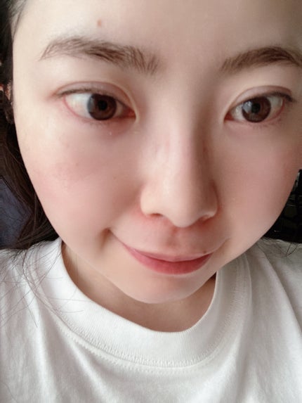 リードルS PDRN+ マスク/VT/シートマスク・パックを使ったクチコミ(2枚目)