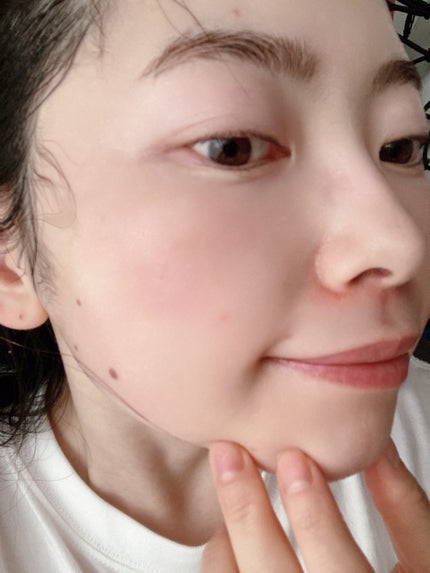 リードルS PDRN+ マスク/VT/シートマスク・パックを使ったクチコミ(5枚目)