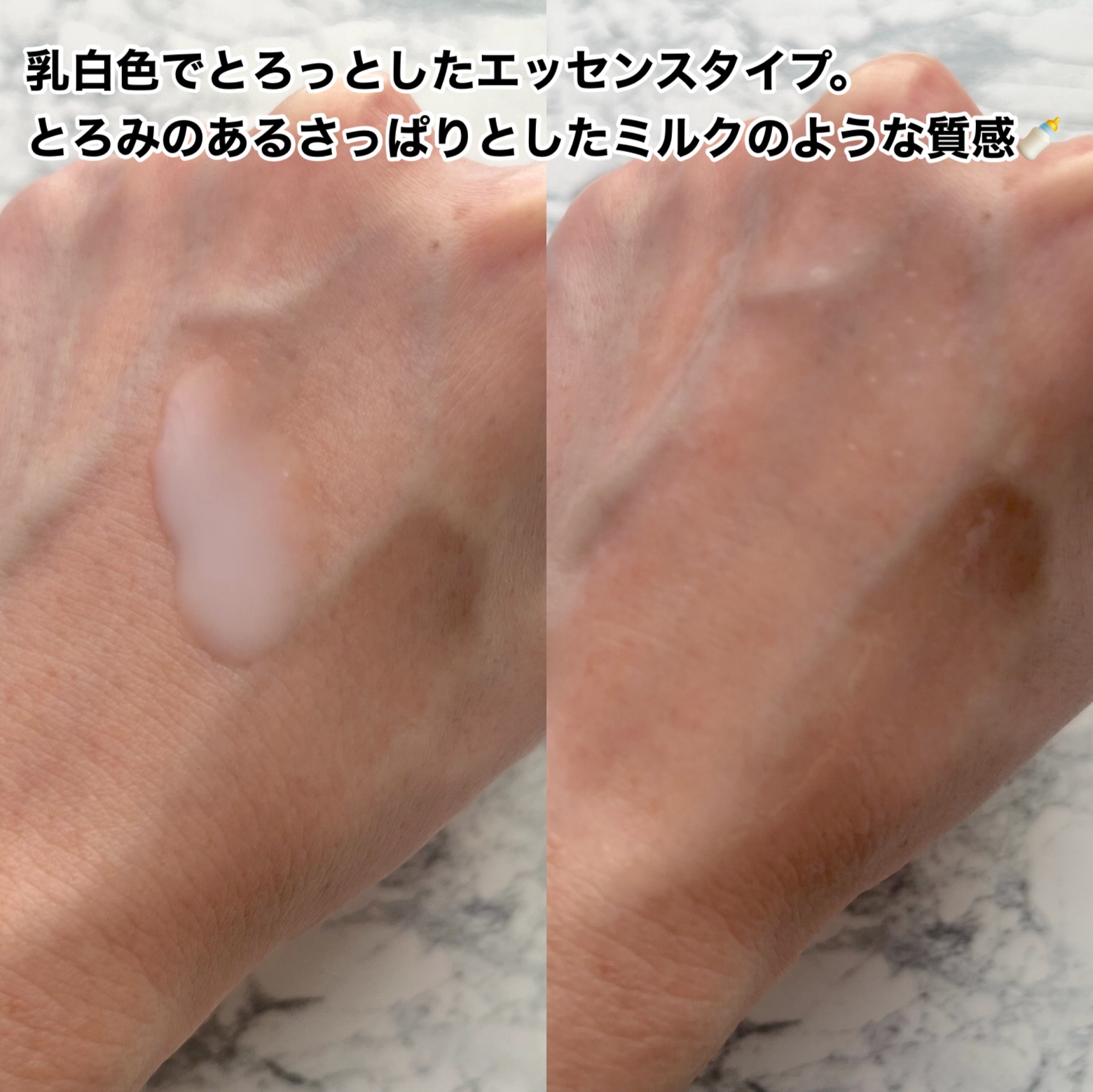 米セラミドエッセンストナー/FULLY/化粧水を使ったクチコミ（3枚目）