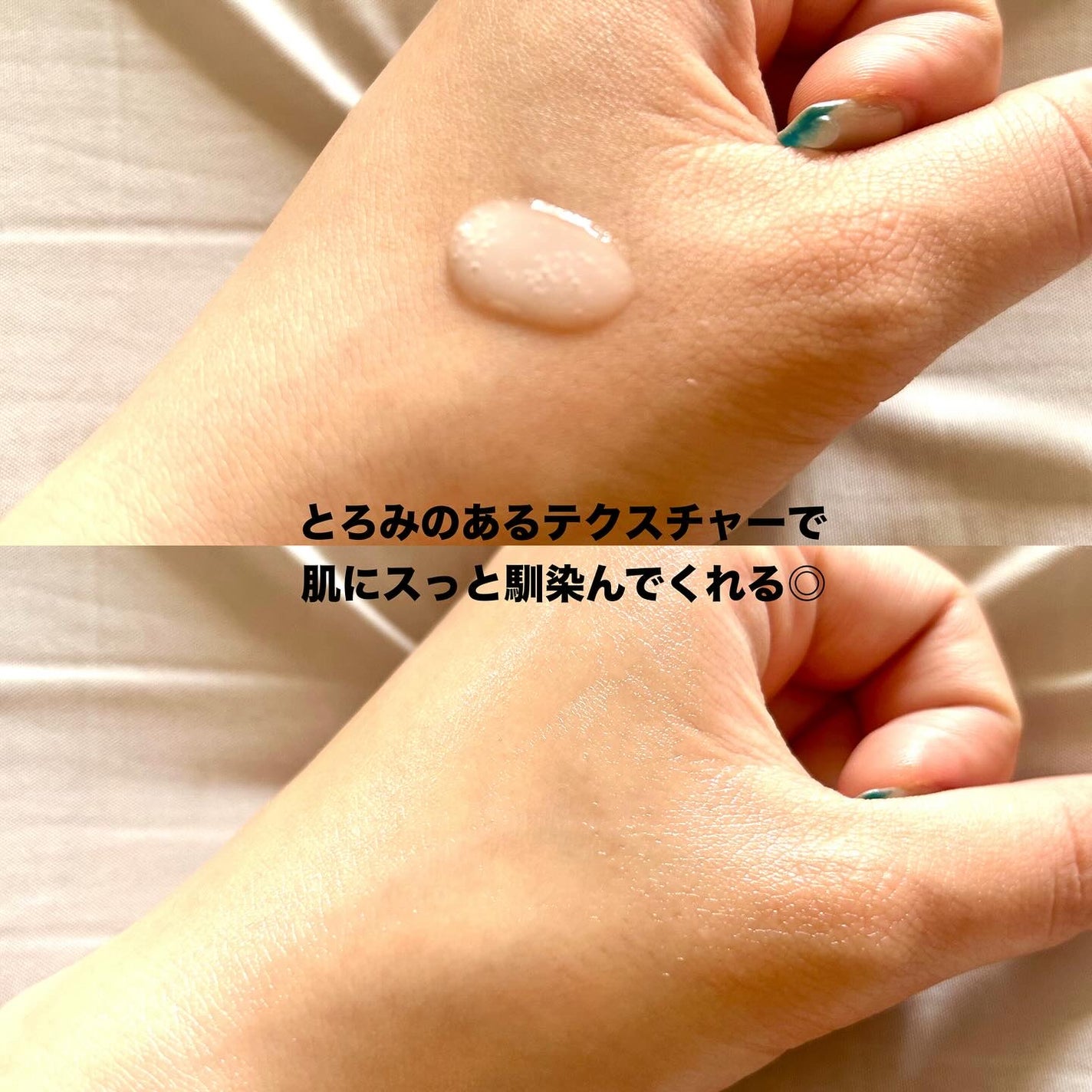 グルタチオンラディアンスセラム/SKIN&LAB/美容液を使ったクチコミ(5枚目)