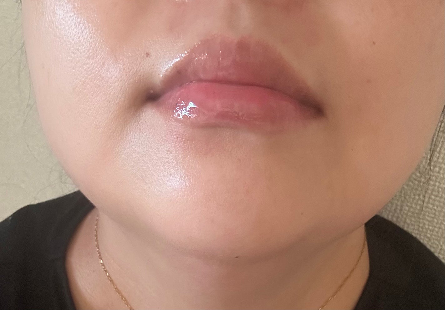 Q+Me ボムショットリッププランパー+/AGARISM/リッププランパーを使ったクチコミ(2枚目)