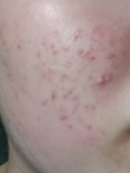 ã䜿ã£ãã¯ãã³ãïŒ1æç®ïŒ