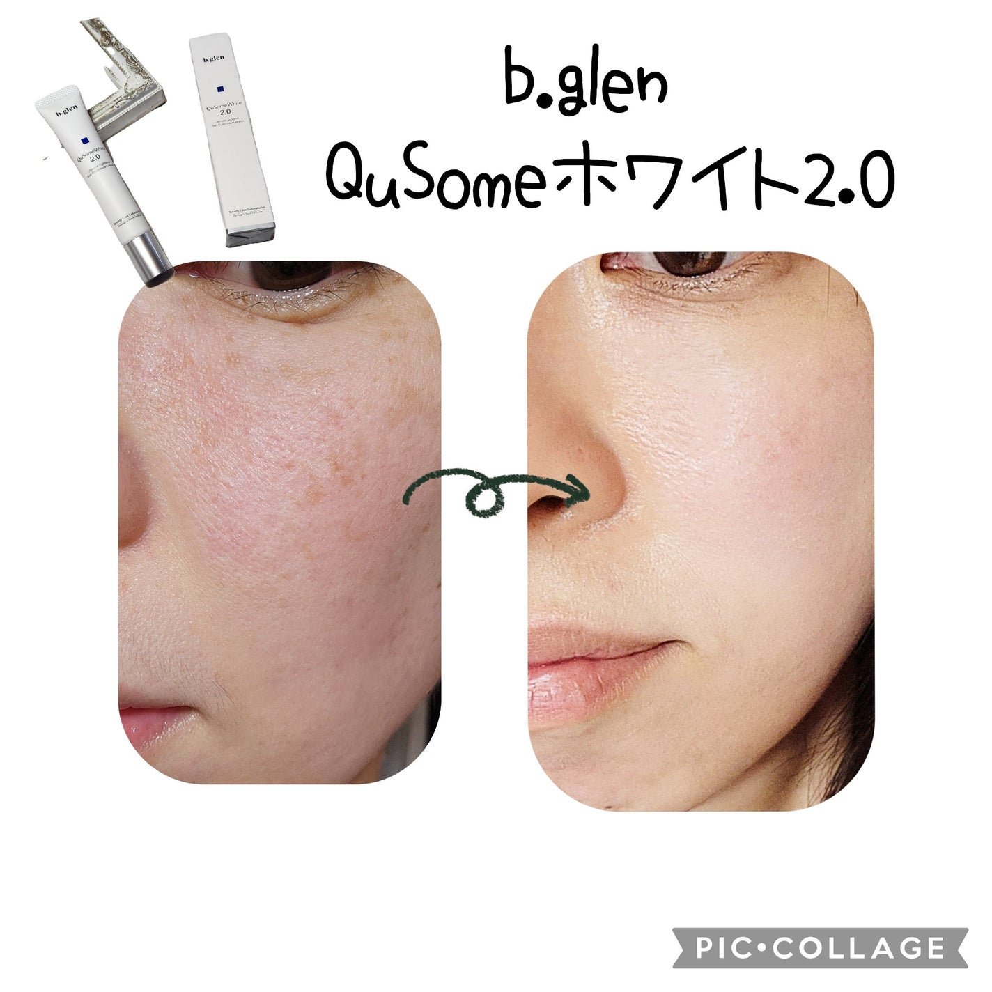 QuSomeホワイト2.0/b.glen/美容液を使ったクチコミ(4枚目)