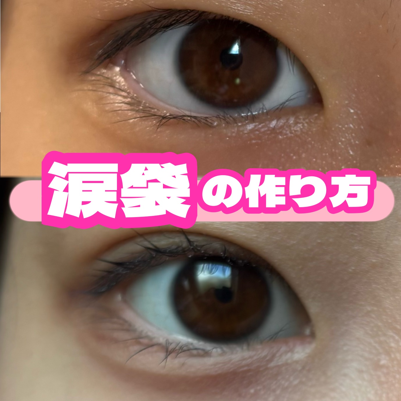 カラーミキシングコンシーラー/キャンメイク/パレットコンシーラーを使ったクチコミ（1枚目）