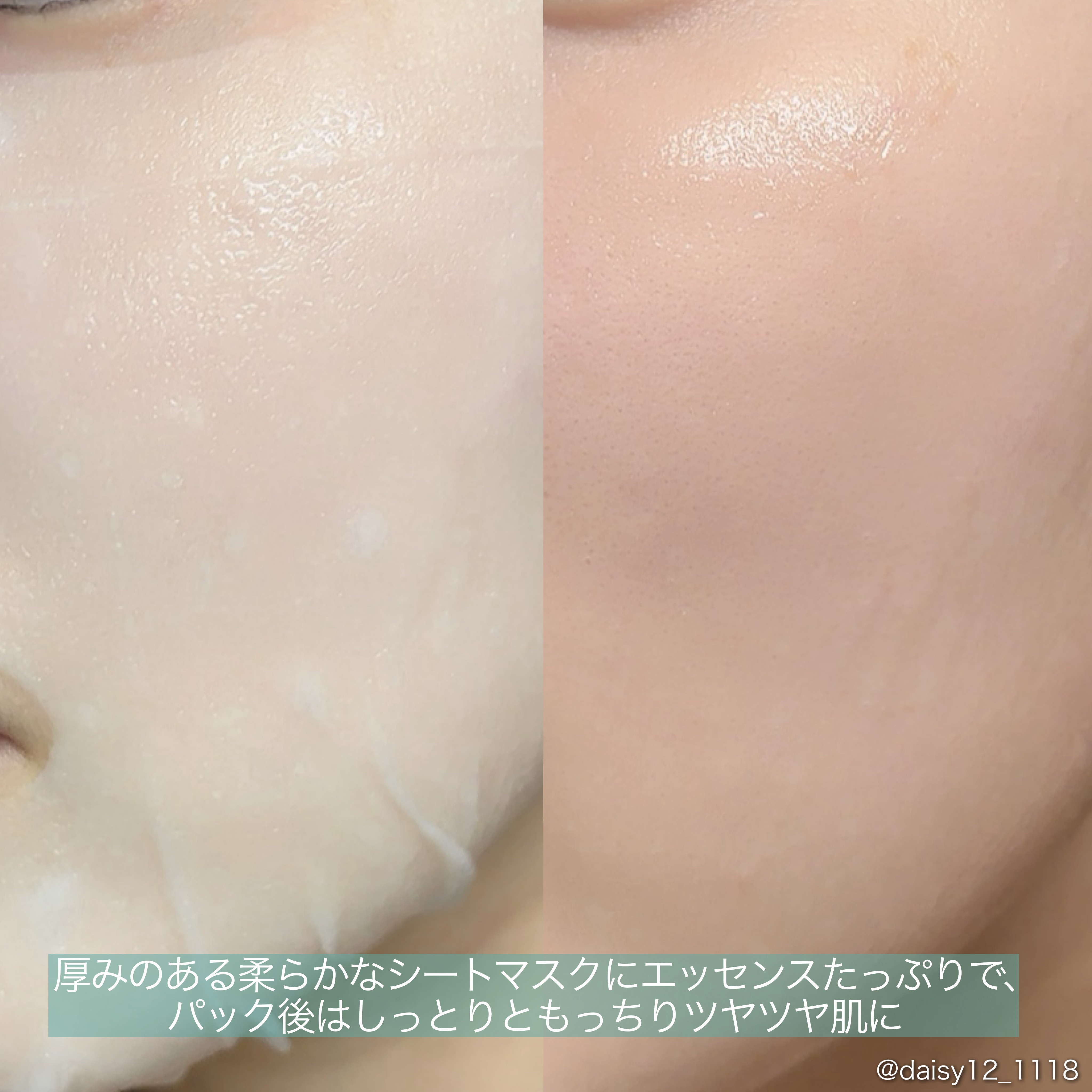 リードルS PDRN+ マスク/VT/シートマスク・パックを使ったクチコミ（3枚目）