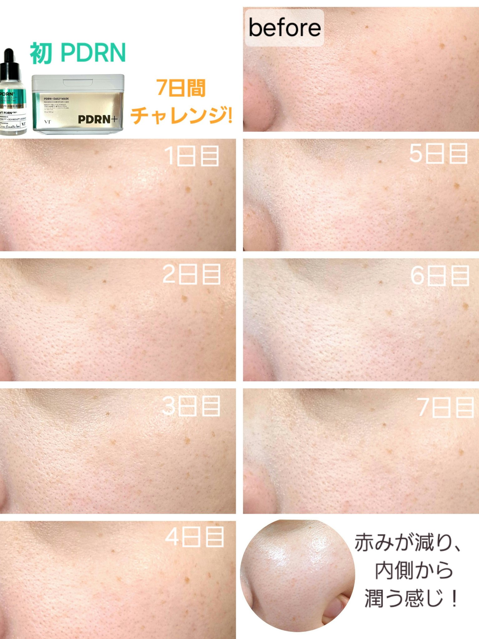リードルS PDRN+ セラム/VT/美容液を使ったクチコミ（3枚目）