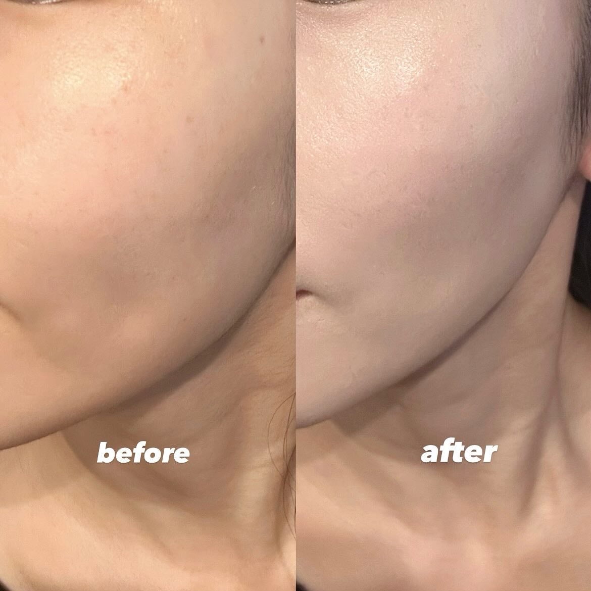 ヘルシーグロウクッション/heyooo/クッションファンデーションを使ったクチコミ(5枚目)