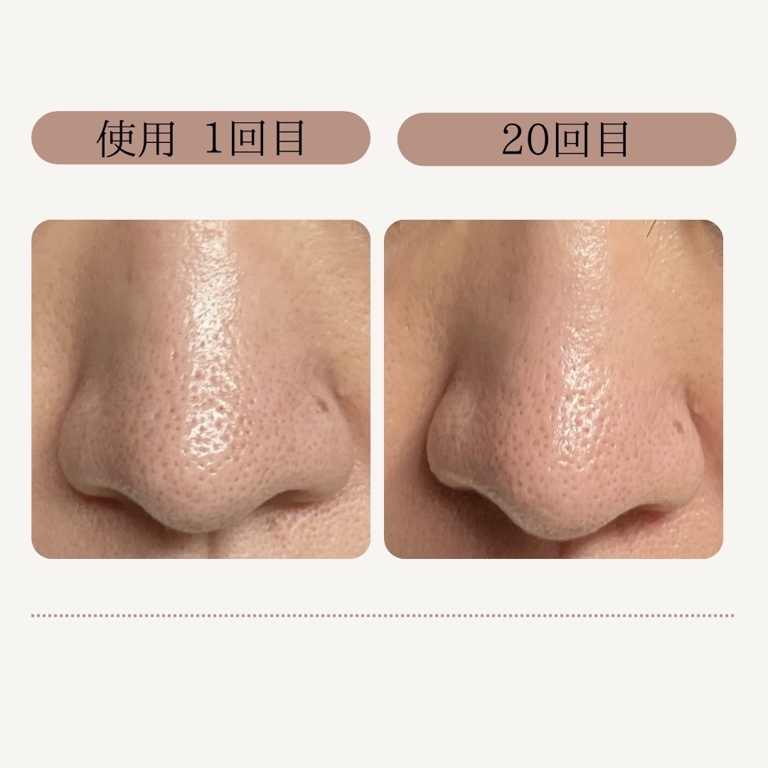 AQ 毛穴美容液オイル/DECORTÉ/フェイスオイルを使ったクチコミ（2枚目）