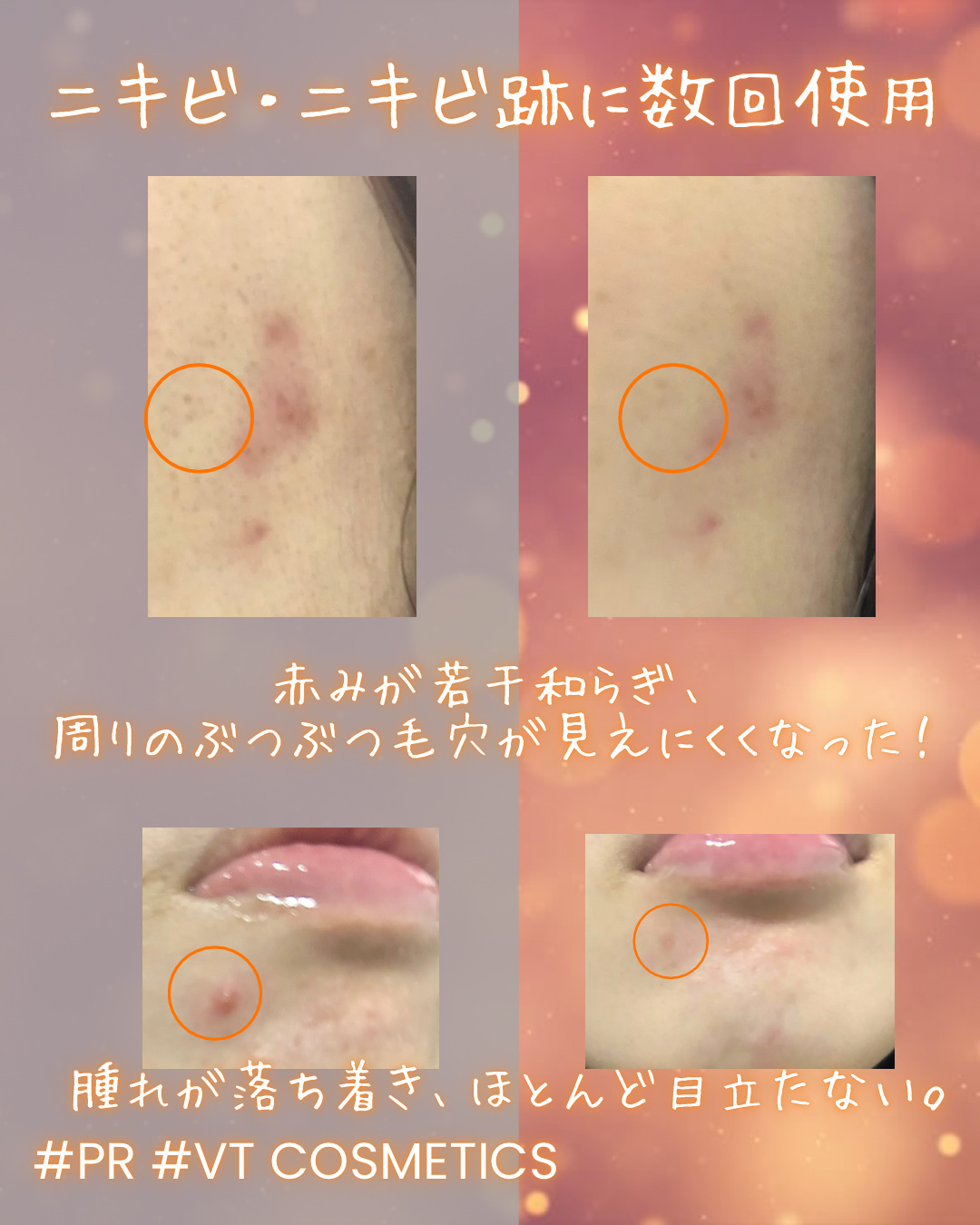 A1カーミング アンプル/VT/美容液を使ったクチコミ（3枚目）