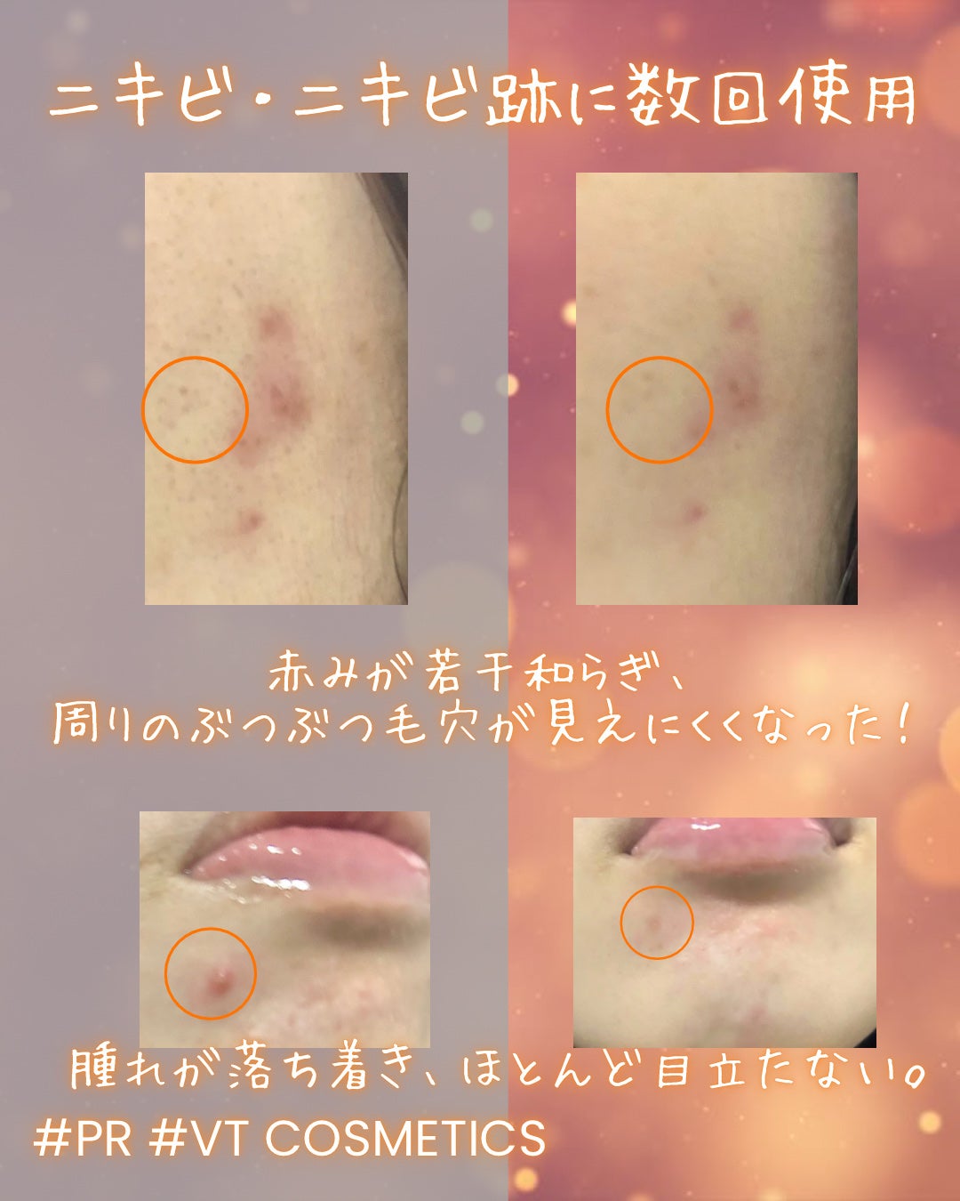 A1カーミング アンプル/VT/美容液を使ったクチコミ(3枚目)