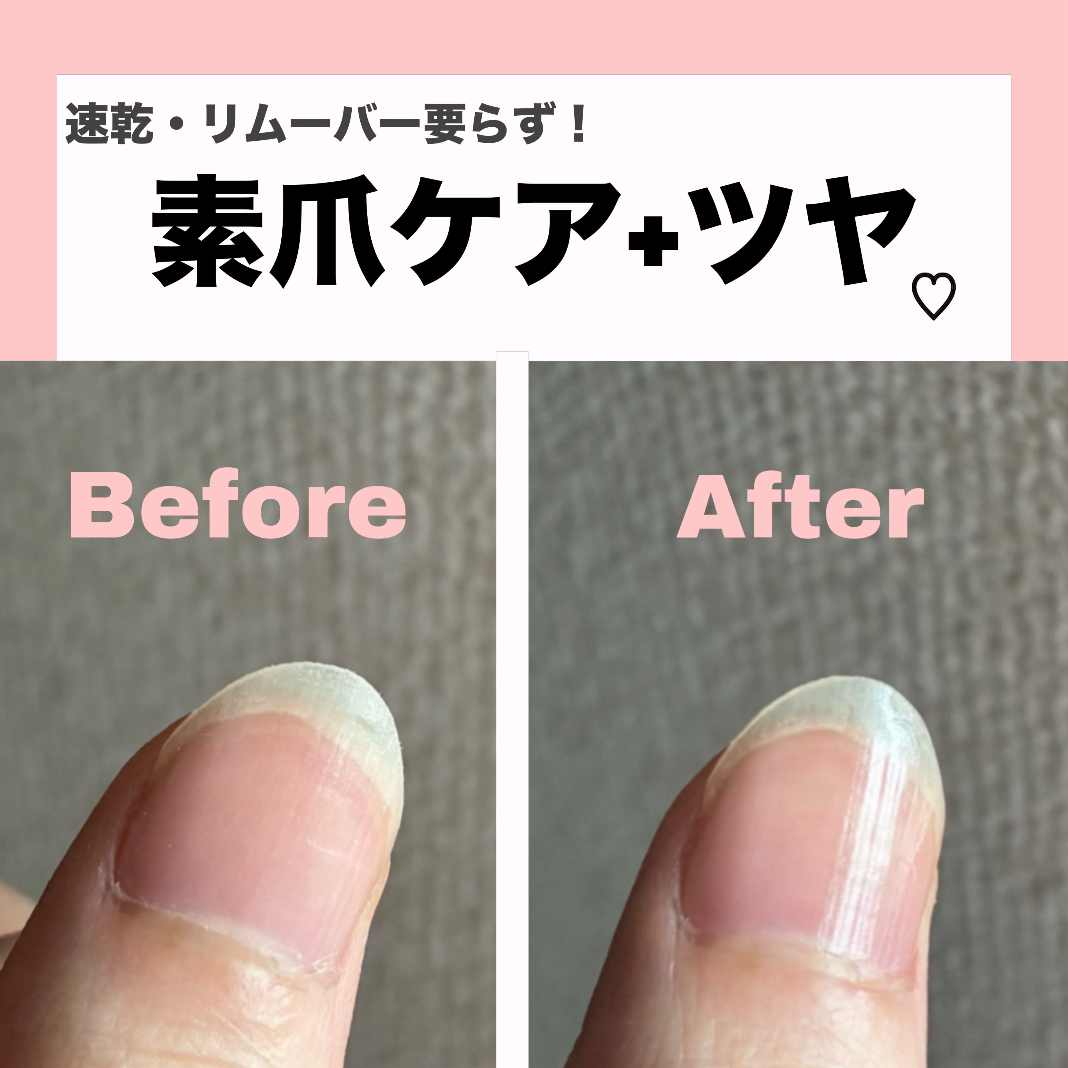 エテュセ クイックケアコート/ettusais/ネイルオイル・トリートメントを使ったクチコミ（1枚目）