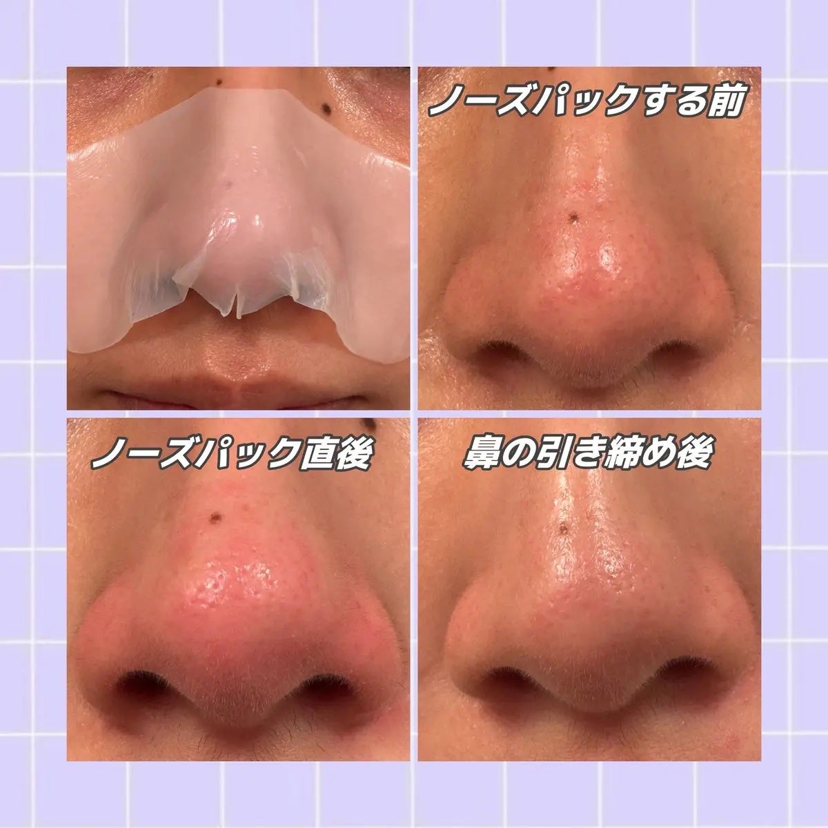 ナチュラルマイルドクリアノーズパック/ilso/シートマスク・パックを使ったクチコミ(2枚目)