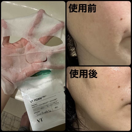 リードルS PDRN+ マスク/VT/シートマスク・パックを使ったクチコミ(3枚目)