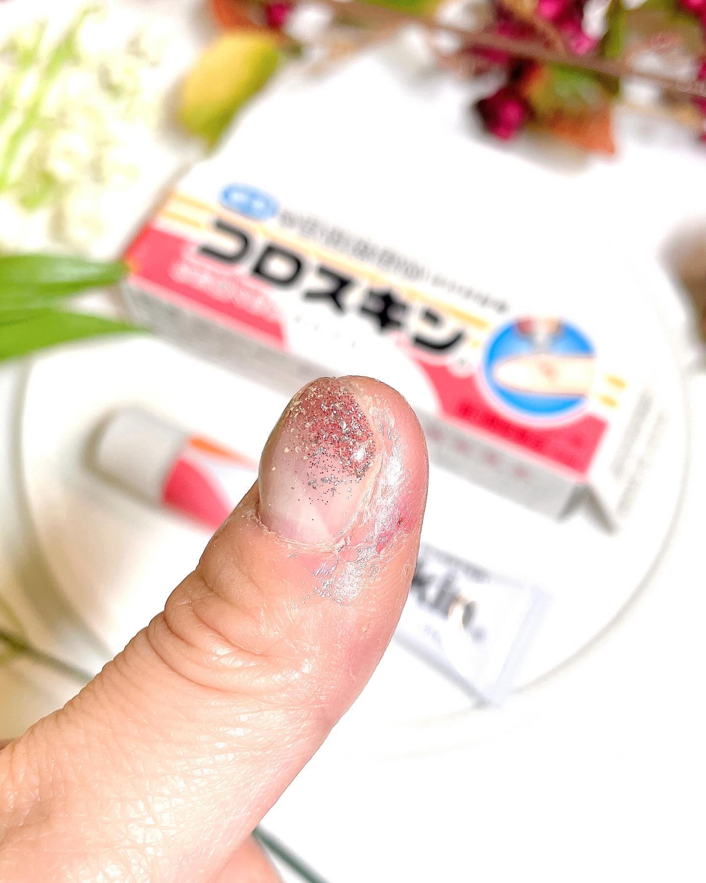 コロスキン（医薬品）/東京甲子社/その他を使ったクチコミ（3枚目）