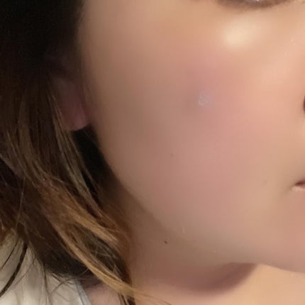 ACマグネシウムパッチ/スノーツープラス/シートマスク・パックを使ったクチコミ(6枚目)