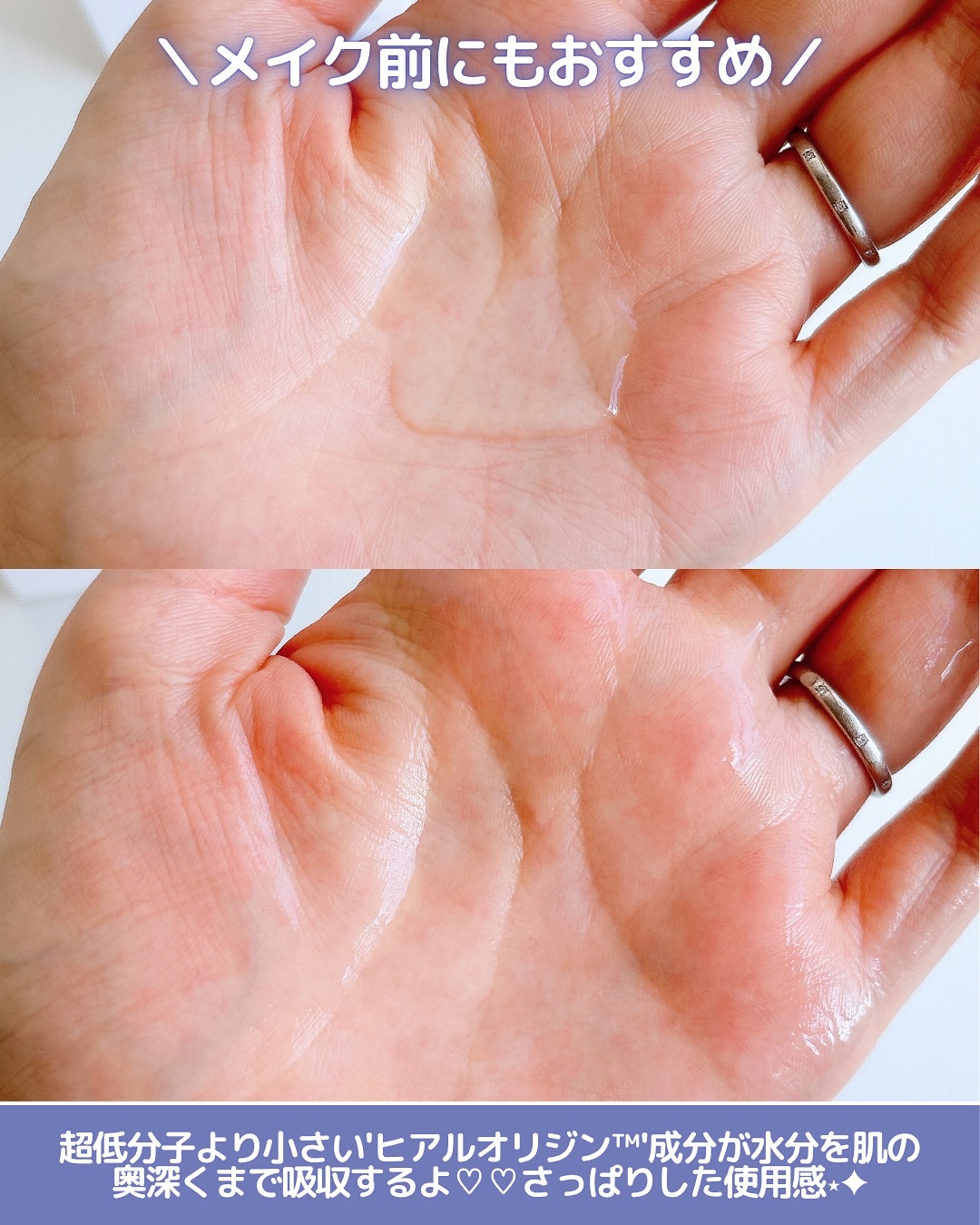 オリゴヒアルロン酸ディープトナー/THE LAB by blanc doux(ザラボバイブランドゥ)/化粧水を使ったクチコミ（3枚目）