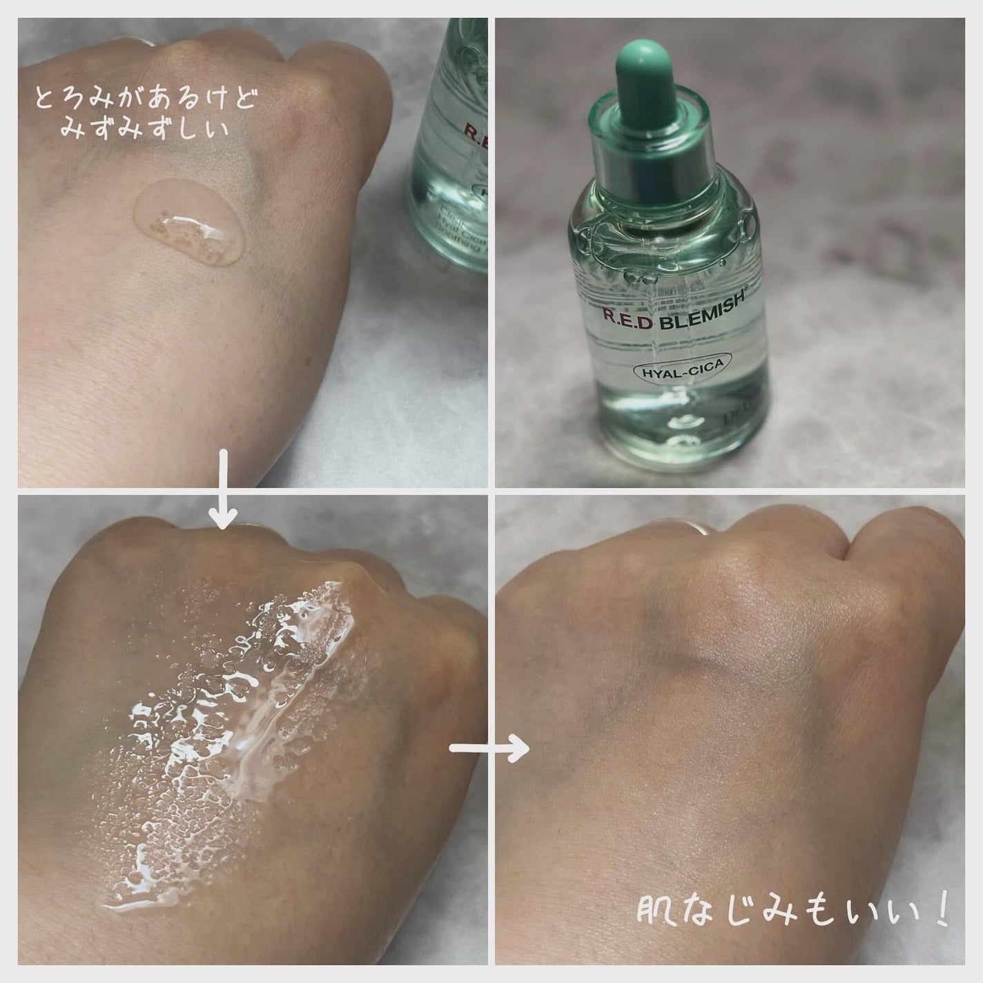 レッドブレミッシュ クリアスージングクリーム/Dr.G/フェイスクリームを使ったクチコミ(4枚目)