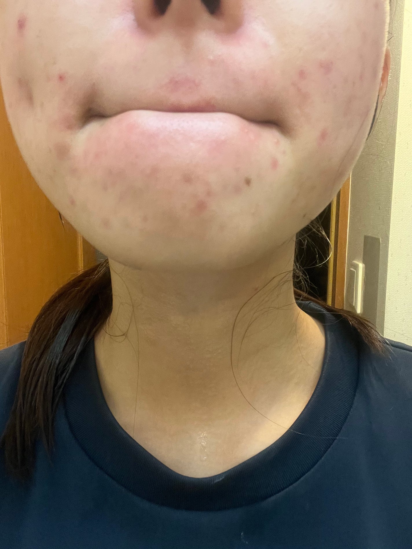 も on LIPS 「顎がマシになっている。飲み薬たちがきれて、最近あまり飲んでいな..」(2枚目)