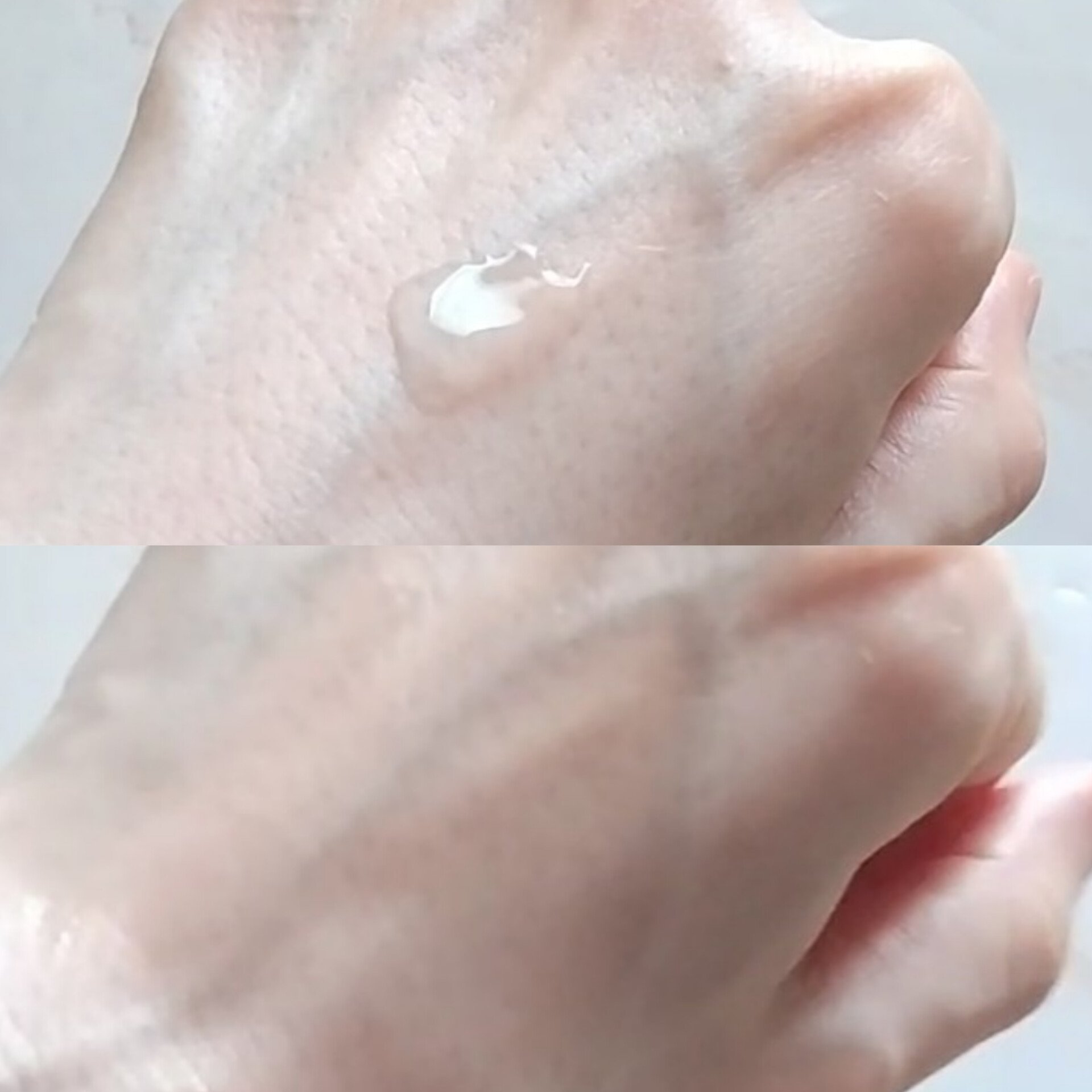 足小路麗子 薬用 フットケアジェル/ナリスアップ/レッグ・フットケアを使ったクチコミ（2枚目）