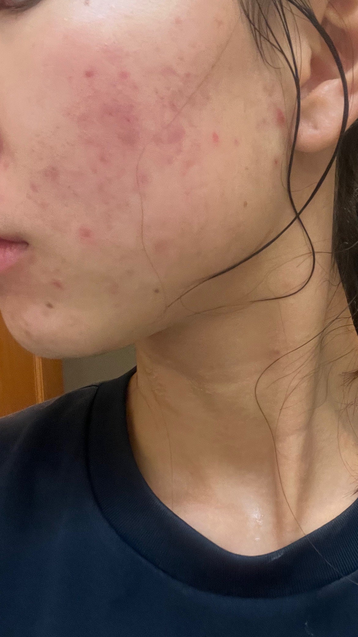 も on LIPS 「顎がマシになっている。飲み薬たちがきれて、最近あまり飲んでいな..」(3枚目)