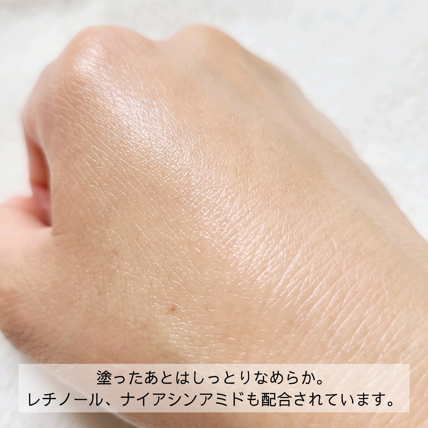 ガラクトポアセバムケアクリーム/SAM'U/フェイスクリームを使ったクチコミ(3枚目)
