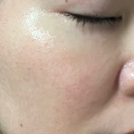 PHセンシティブマスク クールフィット/SAM'U/シートマスク・パックを使ったクチコミ(5枚目)