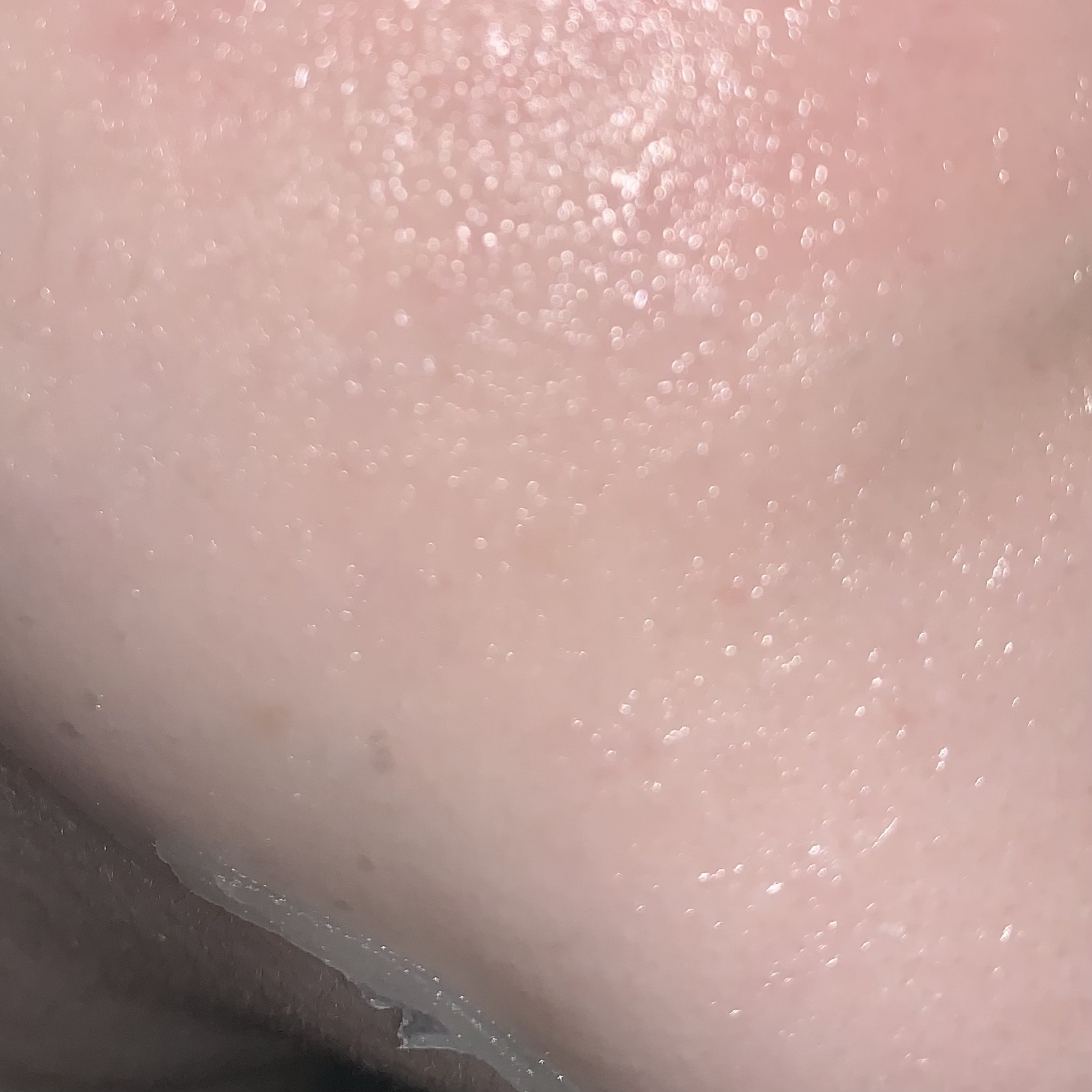 PDRNヒアルロン酸 カプセル100セラムマスクパック/Anua/シートマスク・パックを使ったクチコミ（1枚目）