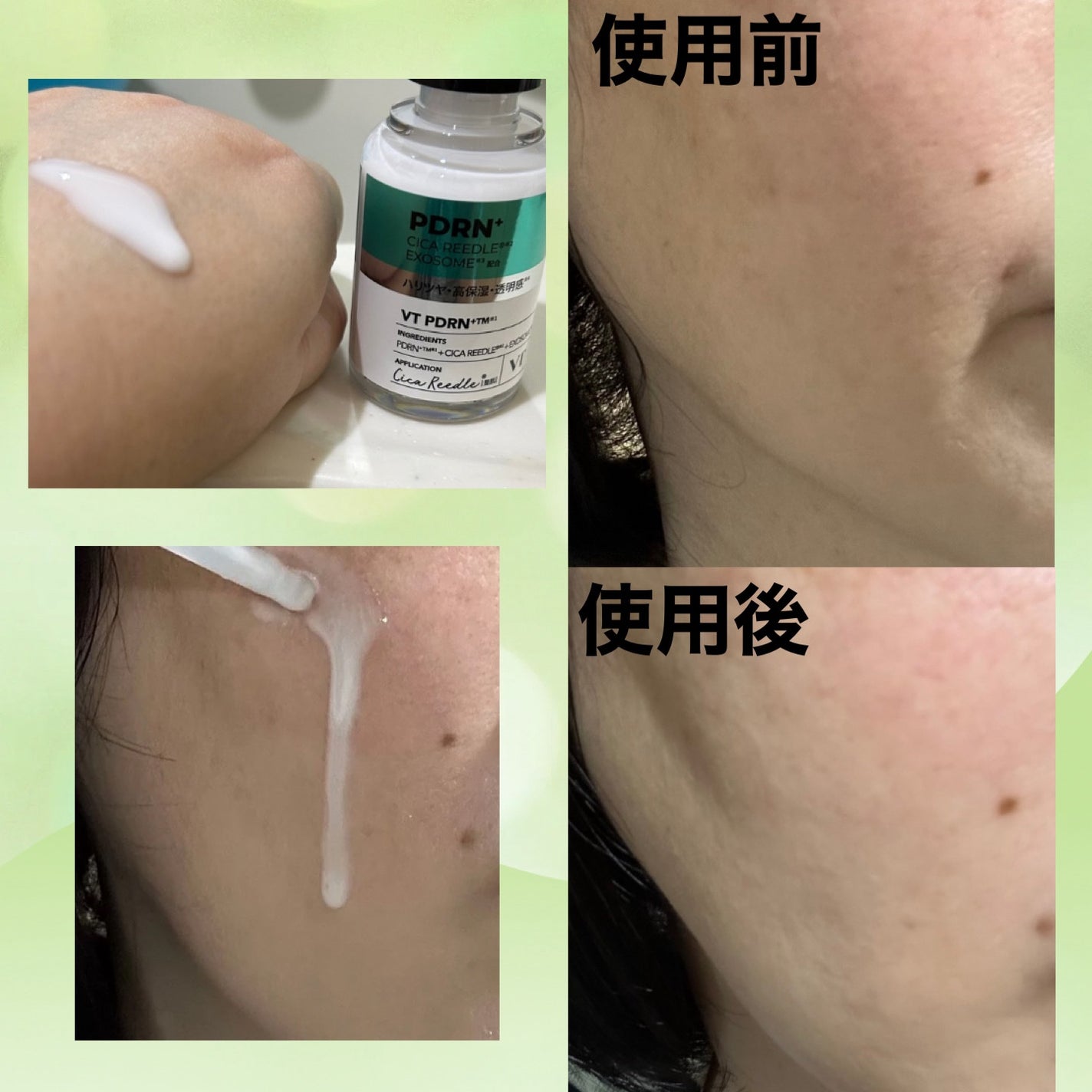 リードルS PDRN+ セラム/VT/美容液を使ったクチコミ(3枚目)