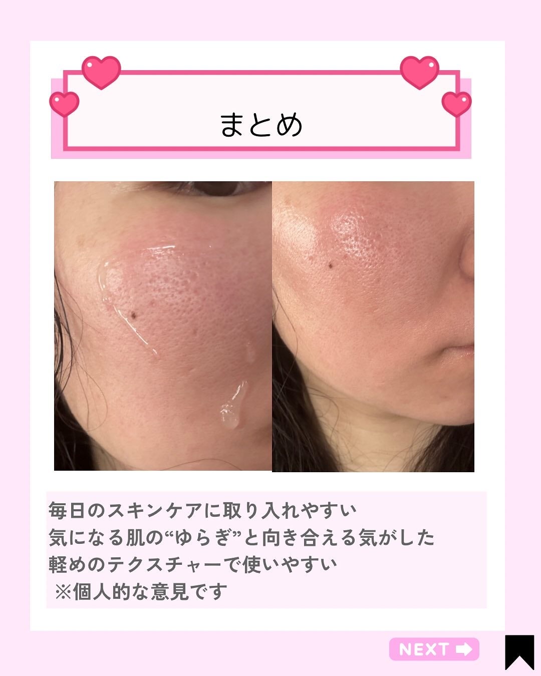 Kana on LIPS ãð¹èã®ããããæ°ã«ãªãæã«ãé Œããååšæè¿ããè³ã«ããâã¢ãŒã©..ãïŒ4æç®ïŒ