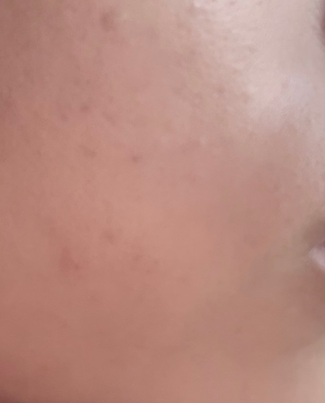 ダーマシンコンシーラー/23years old/リキッドコンシーラーを使ったクチコミ(6枚目)