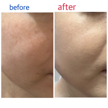 ても on LIPS 「つけごこちがよく、厚塗りしなくても自然なカバー。また、ワンプッ..」(2枚目)