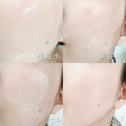 アゼペア 美容液/ネイチャーリパブリック/美容液を使ったクチコミ(8枚目)