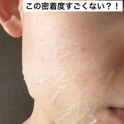 PDRNヒアルロン酸 カプセル100セラムマスクパック/Anua/シートマスク・パックを使ったクチコミ(3枚目)