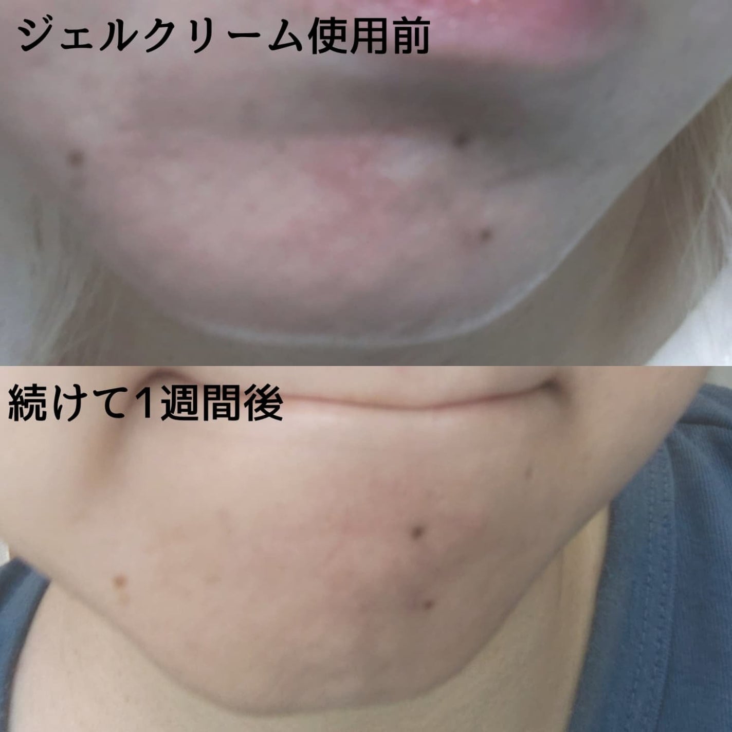 AZケア クレンジングオイル/VT/オイルクレンジングを使ったクチコミ(5枚目)