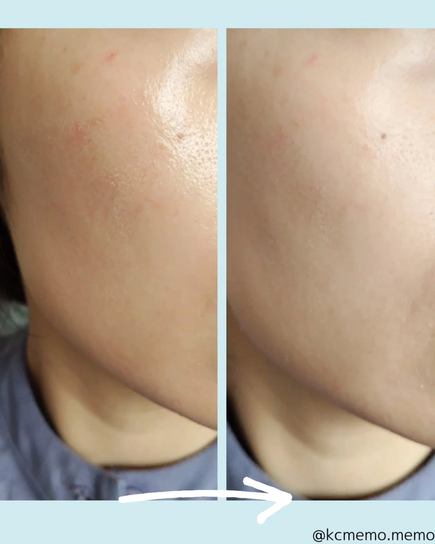 メモ魔ちゃん@韓国コスメメモ日記 on LIPS 「メガ割購入品レポー!トコボです!メイクの上から使えるサンクッシ..」(4枚目)