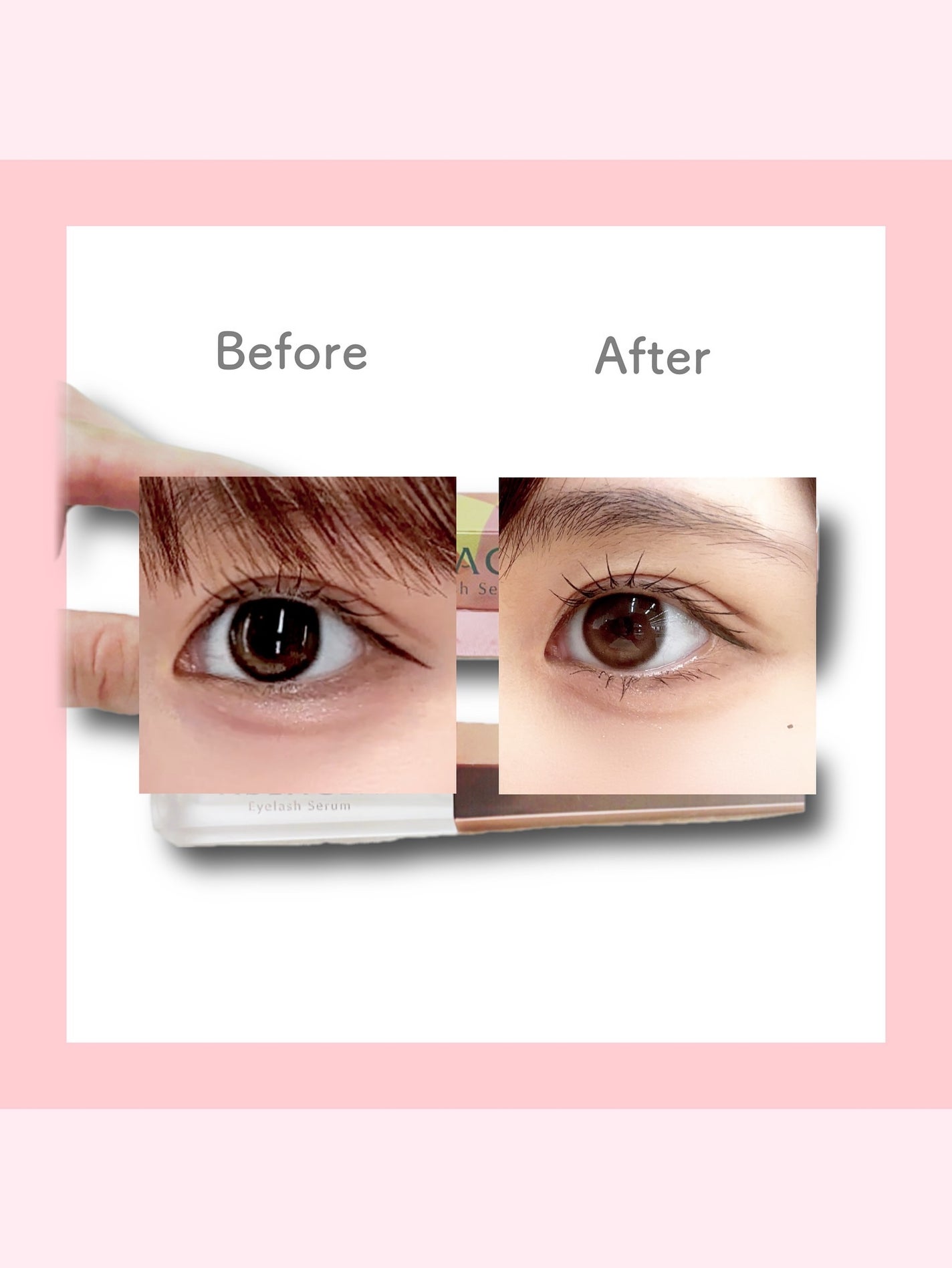 アイラッシュセラム まつげ美容液/ABEAGEN/まつげ美容液を使ったクチコミ(2枚目)