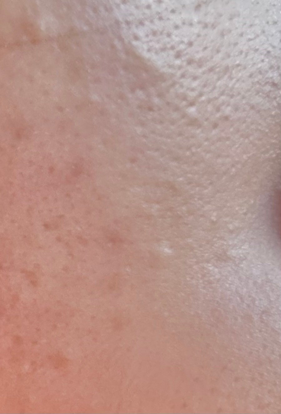 ダーマシンコンシーラー/23years old/リキッドコンシーラーを使ったクチコミ(5枚目)