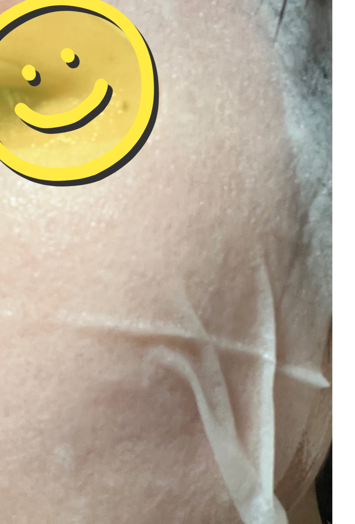 ヒアルロン酸シートマスク/tenzero/シートマスク・パックを使ったクチコミ（2枚目）