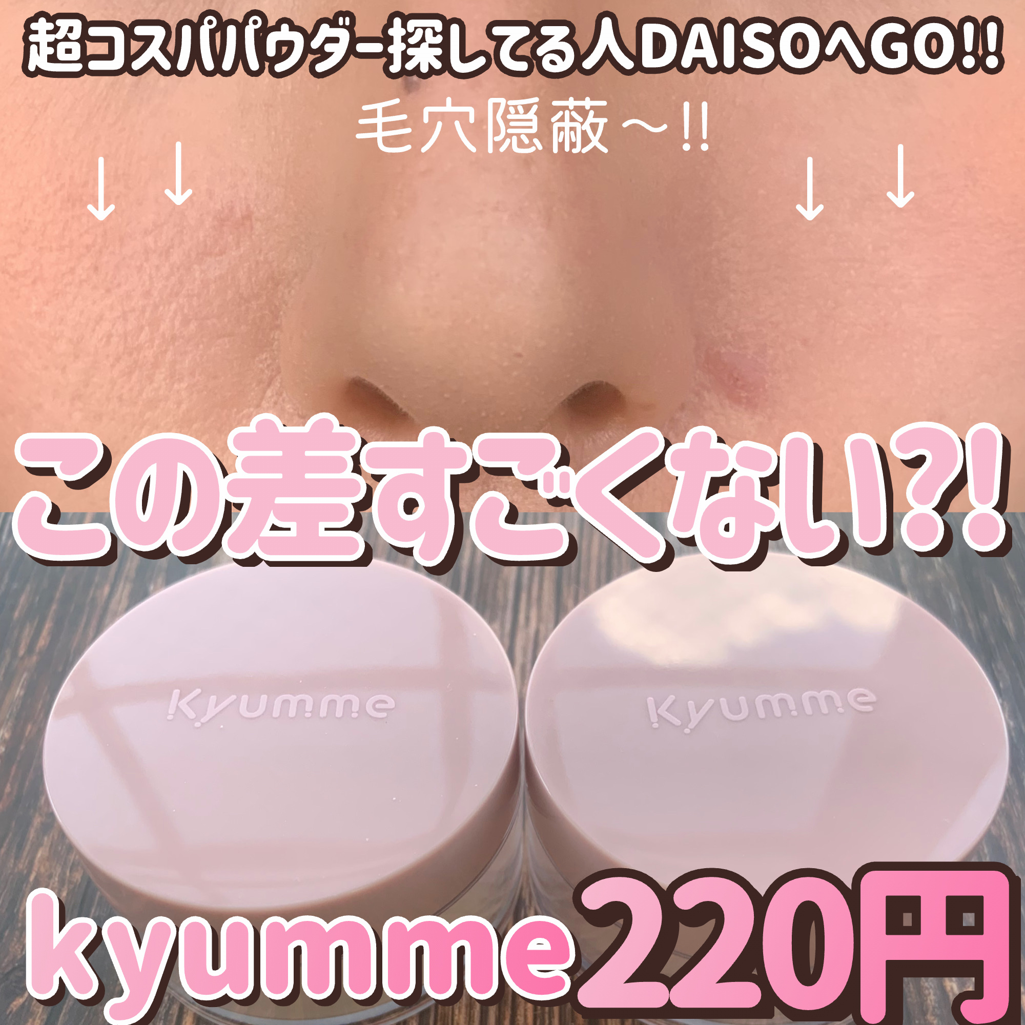 KM  ルースパウダー/DAISO/ルースパウダーを使ったクチコミ（1枚目）