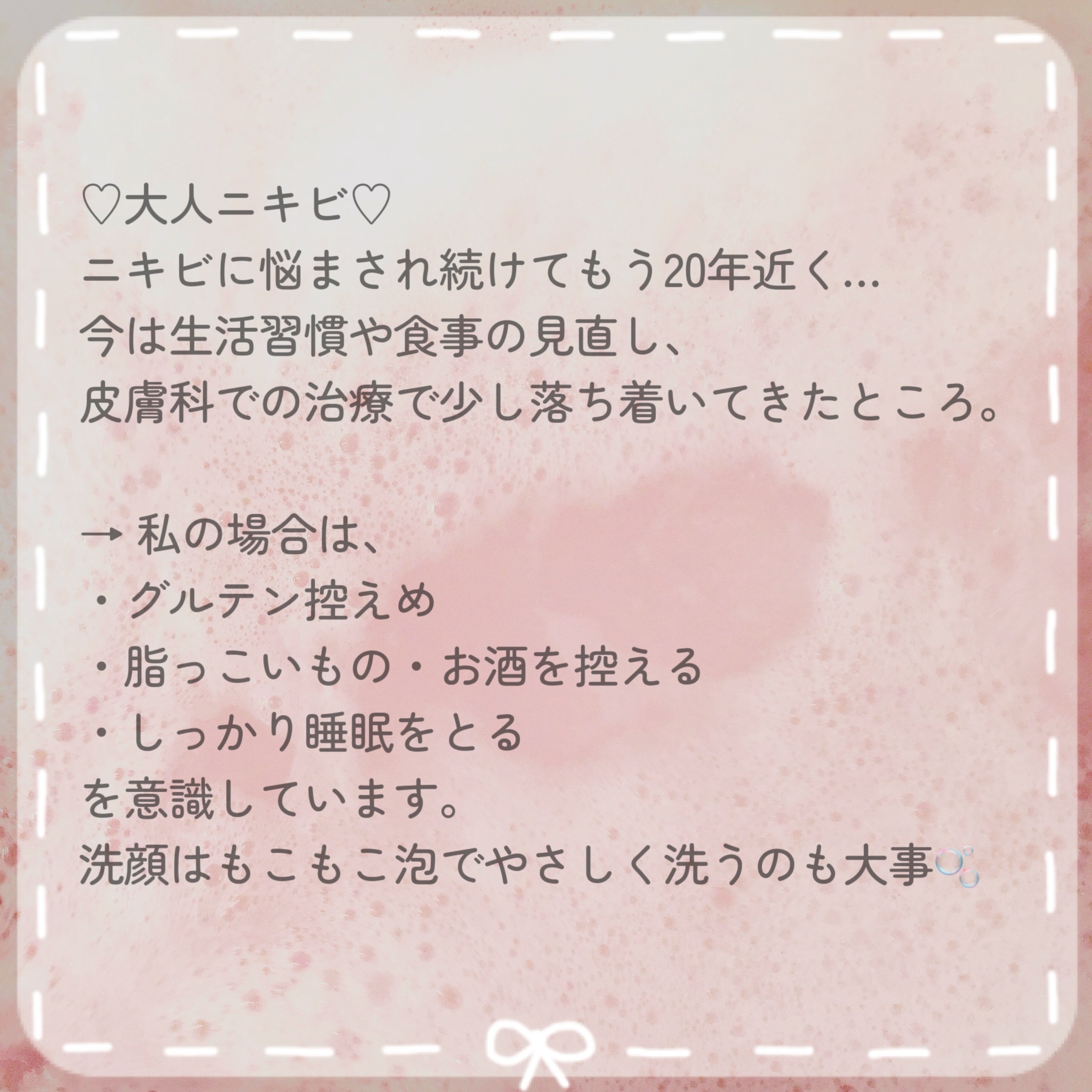 薬用洗顔フォーム/スキンライフ/洗顔フォームを使ったクチコミ（3枚目）