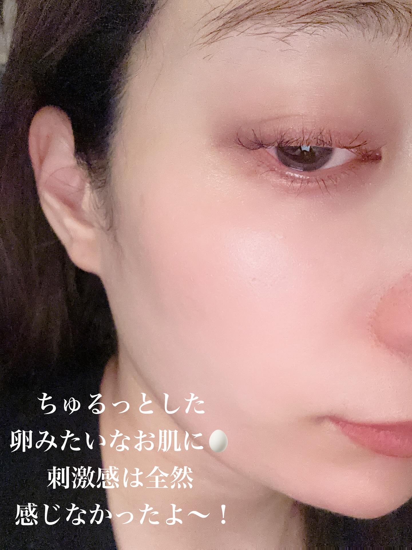 PDRNバクチオールセラム/ONE THING/美容液を使ったクチコミ（3枚目）