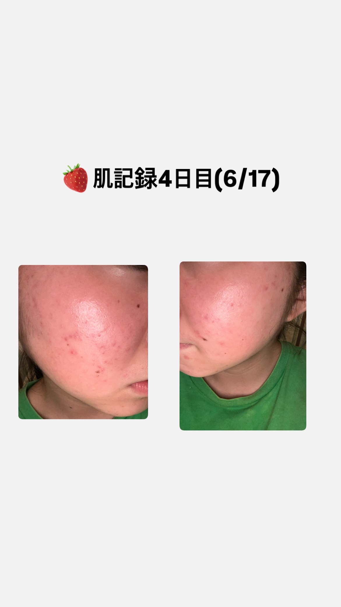 を使ったクチコミ（1枚目）