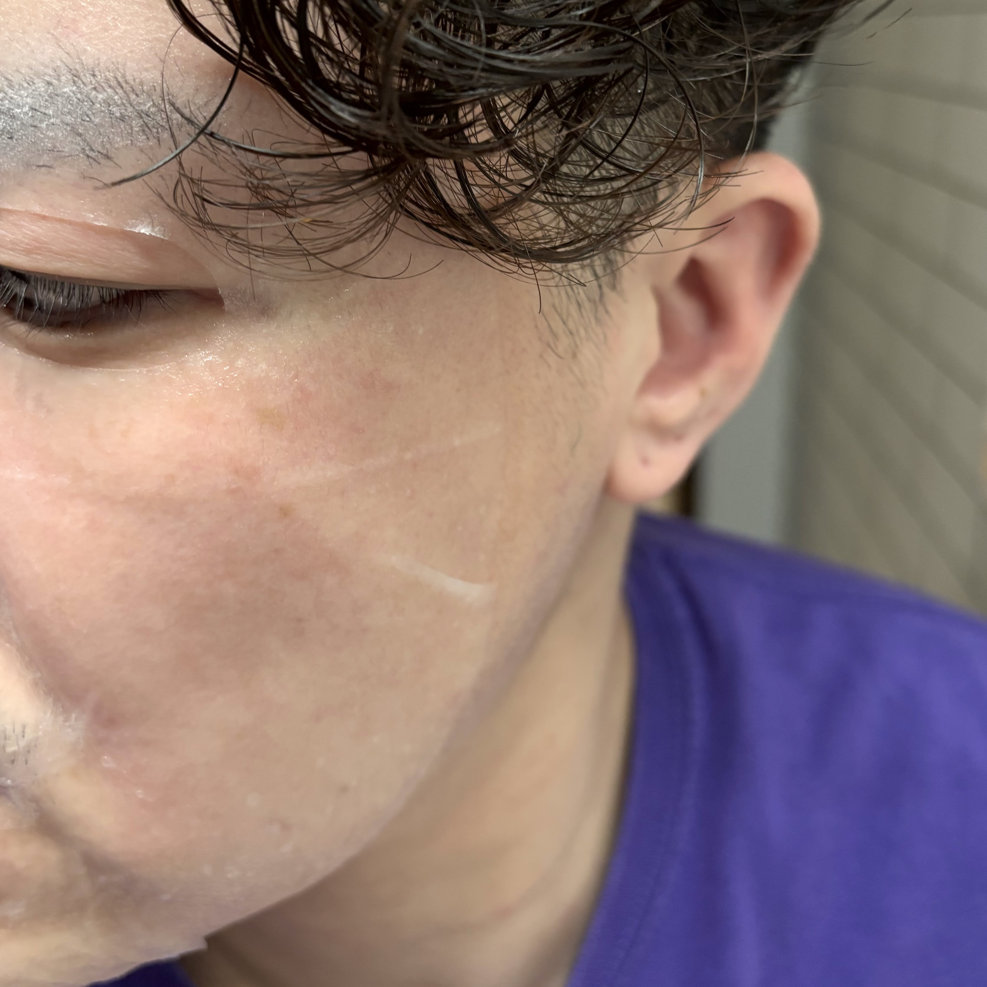 PHセンシティブマスク クールフィット/SAM'U/シートマスク・パックを使ったクチコミ（3枚目）