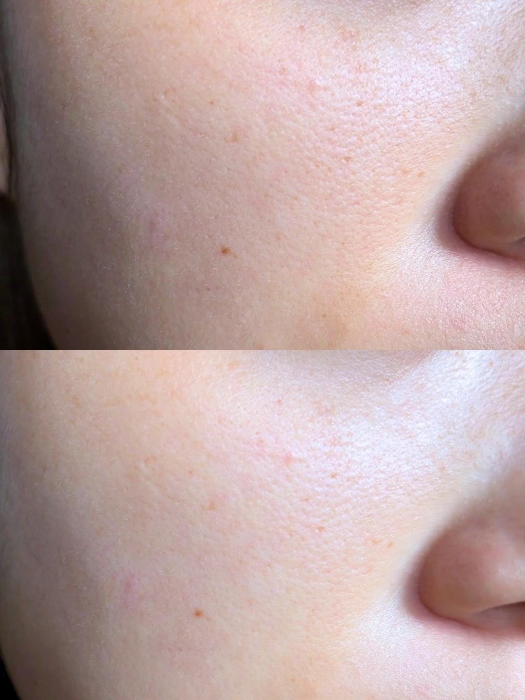 オバジC クリアアドバンスドローション/オバジ/化粧水を使ったクチコミ(2枚目)