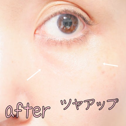 QuSomeホワイト2.0/b.glen/美容液を使ったクチコミ(6枚目)