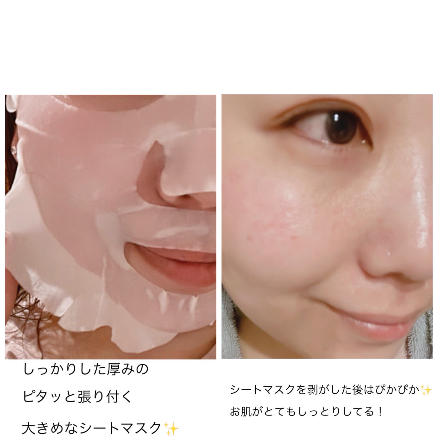 リードルS PDRN+ マスク/VT/シートマスク・パックを使ったクチコミ(6枚目)